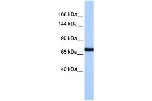 PCDH15 antibody used at 1 ug/ml to detect target protein. (PCDH15 抗体  (N-Term))
