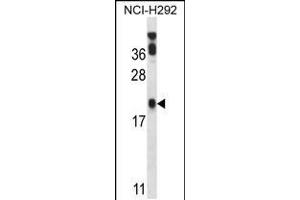 Western blot analysis in NCI-H292 cell line lysates (35ug/lane). (PERP 抗体  (C-Term))