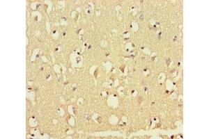 Immunohistochemistry of paraffin-embedded human brain tissue using ABIN7172553 at dilution of 1:100 (GATA6 抗体  (AA 496-595))