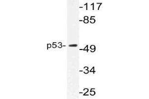 Western blot (WB) analysis of p53 antibody in extracts from K562 cells. (p53 抗体)