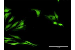 Immunofluorescence of purified MaxPab antibody to LOC541473 on HeLa cell. (LOC541473 抗体  (AA 1-131))