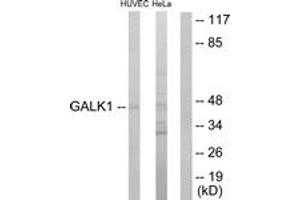 Western blot analysis of extracts from HuvEc/HeLa cells, using GALK1 Antibody. (GALK1 抗体  (AA 1-50))