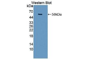 Western blot analysis of the recombinant protein. (MMP15 抗体  (AA 280-497))