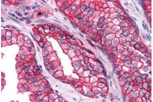 Human Prostate: Formalin-Fixed, Paraffin-Embedded (FFPE) (SNAP23 抗体  (AA 1-132))