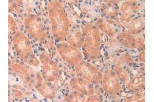 Immunohistochemistry (IHC) image for anti-Angiopoietin-Like 2 (ANGPTL2) (AA 267-493) antibody (ABIN7434344)
