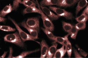 Immunofluorescent staining of HeLa cells. (PRKACA 抗体  (AA 18-347))