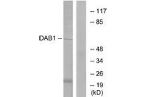 Western blot analysis of extracts from HeLa cells, using Dab1 (Ab-220) Antibody.