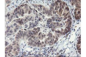 Image no. 3 for anti-LanC like 2 (LANCL2) (AA 212-450) antibody (ABIN1491208)