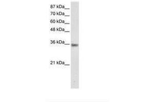 Image no. 1 for anti-Menage A Trois Homolog 1, Cyclin H Assembly Factor (Xenopus Laevis) (MNAT1) (C-Term) antibody (ABIN202213)