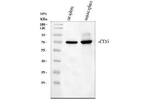 Western blot analysis of CD5 using anti-CD5 antibody (ABIN5693203). (CD5 抗体  (AA 25-495))