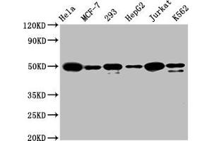 Western Blot Positive WB detected in: Hela whole cell lysate, MCF-7 whole cell lysate, 293 whole cell lysate, HepG2 whole cell lysate, Jurkat whole cell lysate, K562 whole cell lysate All lanes: ATF4 antibody at 1. (Recombinant ATF4 抗体)