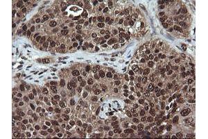 Image no. 2 for anti-Von Hippel-Lindau Tumor Suppressor, E3 Ubiquitin Protein Ligase (VHL) antibody (ABIN1501712) (VHL 抗体)