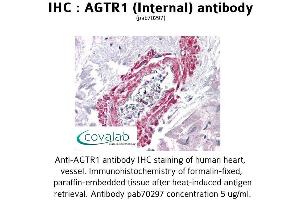 Image no. 1 for anti-Angiotensin II Receptor, Type 1 (AGTR1) (Internal Region) antibody (ABIN1731610)