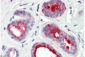 Human Breast (formalin-fixed, paraffin-embedded) stained with PIP antibody ABIN337224 at 2. (PIP 抗体  (AA 24-34))
