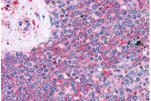 Human Spleen: Formalin-Fixed, Paraffin-Embedded (FFPE)