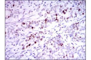 Immunohistochemistry (IHC) image for anti-Inner Centromere Protein Antigens 135/155kDa (INCENP) (AA 369-583) antibody (ABIN1844019) (INCENP 抗体  (AA 369-583))