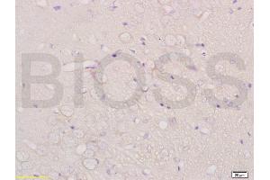 Formalin-fixed and paraffin embedded rat brain labeled with Anti-CHRNA4 Polyclonal Antibody, Unconjugated (ABIN736746) at 1:200 followed by conjugation to the secondary antibody and DAB staining. (CHRNA4 抗体  (AA 531-627))