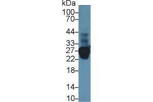 Western Blotting (WB) image for anti-Slow Skeletal Troponin I (TNNI1) (AA 1-187) antibody (ABIN7435427)