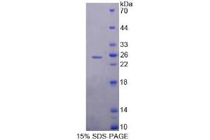 SDS-PAGE analysis of Mouse MEF2A Protein. (MEF2A 蛋白)