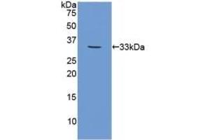 Detection of Recombinant CAPN1, Human using Polyclonal Antibody to Calpain 1 (CAPN1) (CAPN1 抗体  (AA 75-343))
