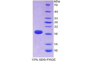 SDS-PAGE analysis of Rat alpha Fodrin Protein. (SPTAN1 蛋白)