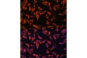 Immunofluorescence analysis of L929 cells using J antibody (ABIN7268035) at dilution of 1:100. (JAG2 抗体  (AA 24-200))