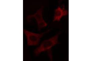 ABIN6274663 staining LOVO cells by IF/ICC. (CYP7B1 抗体  (Internal Region))