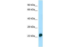 WB Suggested Anti-CRYGA Antibody Titration: 1. (CRYGA 抗体  (N-Term))