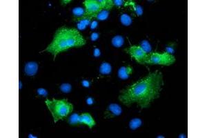 Anti-ARFGAP1 mouse monoclonal antibody (ABIN2454382) immunofluorescent staining of COS7 cells transiently transfected by pCMV6-ENTRY ARFGAP1 (RC206987). (ARFGAP1 抗体)