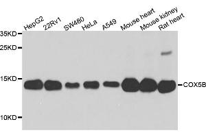 Western blot analysis of extracts of various cell lines, using COX5B antibody (ABIN5974711) at 1/1000 dilution. (COX5B 抗体)