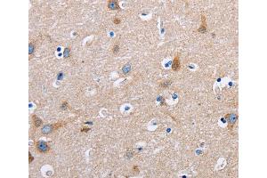 Immunohistochemistry (IHC) image for anti-Fibronectin 1 (FN1) antibody (ABIN2420900) (Fibronectin 1 抗体)