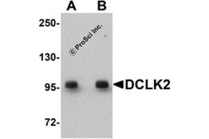 Western Blotting (WB) image for anti-Doublecortin-Like Kinase 2 (DCLK2) (C-Term) antibody (ABIN1030358) (DCLK2 抗体  (C-Term))