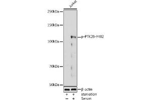 Western blot analysis of extracts of Jurkat cells, using Phospho-PTK2B-Y402 antibody (ABIN3019826, ABIN3019827, ABIN3019828 and ABIN7101865) at 1:1000 dilution.