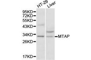 Western Blotting (WB) image for anti-Methylthioadenosine phosphorylase (MTAP) antibody (ABIN1875403) (MTAP 抗体)