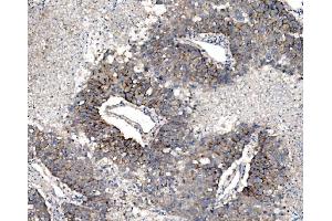 IHC analysis of Claudin 3/CLDN3 using anti-Claudin 3/CLDN3 antibody (ABIN7599626). (Claudin 3 抗体  (AA 101-220))