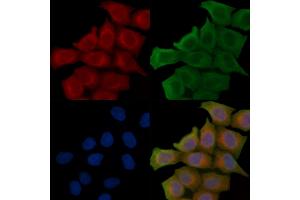 SLCO1B7 Antibody staining Hela cells(45 min of heat-shock treatment) by IF/ICC. (LST-3TM12 抗体)
