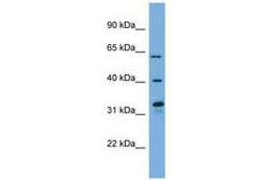 Image no. 1 for anti-Flavin Containing Monooxygenase 3 (FMO3) (N-Term) antibody (ABIN6744773) (FMO3 抗体  (N-Term))