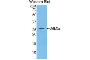 Western blot analysis of the recombinant protein. (Cardiotrophin 1 抗体  (AA 1-203))