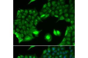 Immunofluorescence analysis of HeLa cells using SSX2 Polyclonal Antibody (SSX2 抗体)
