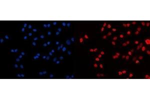 IF analysis of HDAC2 using anti-HDAC2 antibody (ABIN7601564). (HDAC2 抗体  (AA 387-488))