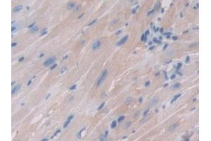 Detection of FTMT in Mouse Heart Tissue using Polyclonal Antibody to Ferritin, Mitochondrial (FTMT)