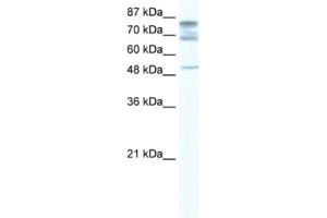 Western Blotting (WB) image for anti-DEAD (Asp-Glu-Ala-Asp) Box Polypeptide 46 (DDX46) antibody (ABIN2461582) (DDX46 抗体)