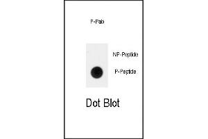 Dot blot analysis of anti-Phospho-RUNX2-p Antibody  on nitrocellulose membrane. (RUNX2 抗体  (pSer465))