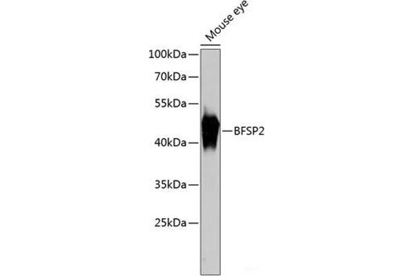 BFSP2 抗体