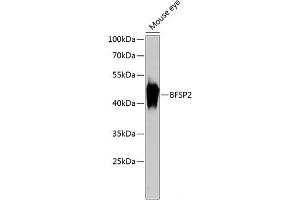 Western blot analysis of extracts of Mouse eye using BFSP2 Polyclonal Antibody at dilution of 1:3000. (BFSP2 抗体)