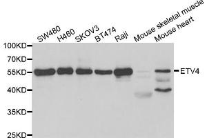 Western blot analysis of extracts of various cell lines, using ETV4 antibody. (ETV4 抗体)