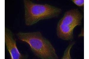Immunofluorescent staining of methanol-fixed Hela cells using PRKCQ (phospho S676) polyclonal antibody  at 1:100-1:200 dilution. (PKC theta 抗体  (pSer676))