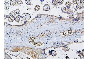 IHC analysis of CETP using anti-CETP antibody (ABIN7602439). (CETP 抗体  (AA 77-353))