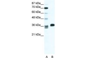 Western Blotting (WB) image for anti-ESX Homeobox 1 (ESX1) antibody (ABIN2461319) (ESX Homeobox 1 抗体)