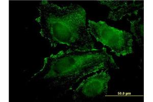 Immunofluorescence of monoclonal antibody to RHOJ on HeLa cell. (RHOJ 抗体  (AA 1-214))